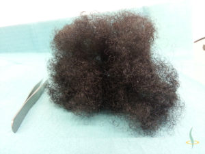 Resim 2: Saç dalgalarının belirginliğini göstermek için Afrikalı saçının bir tutamı 